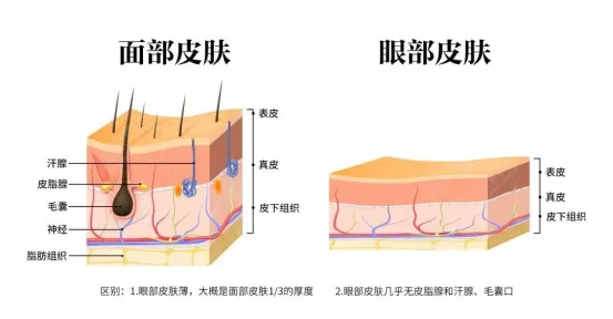 光电方式能改善眼周细纹吗？激光/射频哪种效果更好？