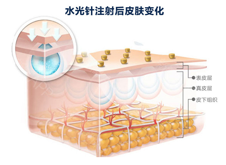 你该怎么改善面部细纹？