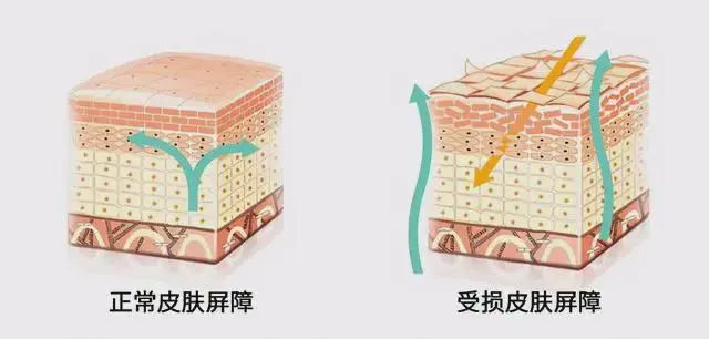 什么是屏障受损？屏障受损应该如何修复？