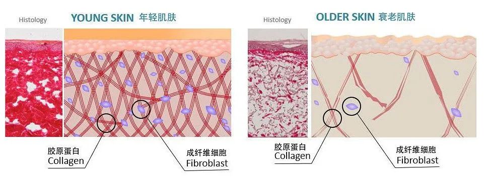 皮肤年轻化的革命性成分：Ⅲ型重组胶原蛋白