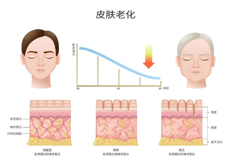 为什么我们的皮肤会衰老下垂？