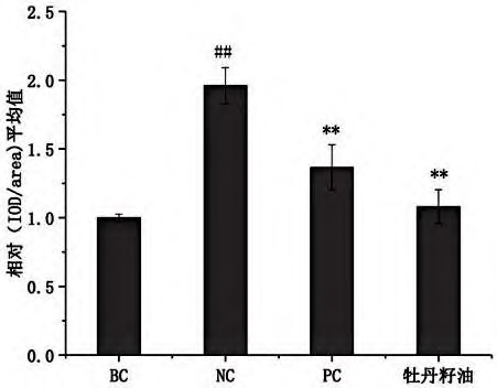 抗衰老新方向，牡丹籽油