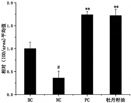 抗衰老新方向，牡丹籽油