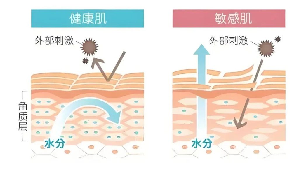 不同的肤质，如何正确抗炎？