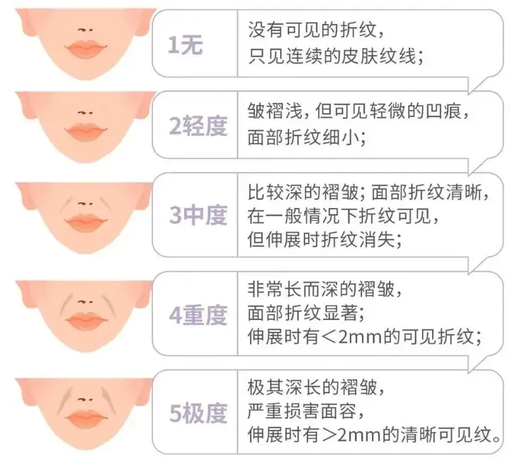 知道这些知识，可以让你的法令纹越来越少！