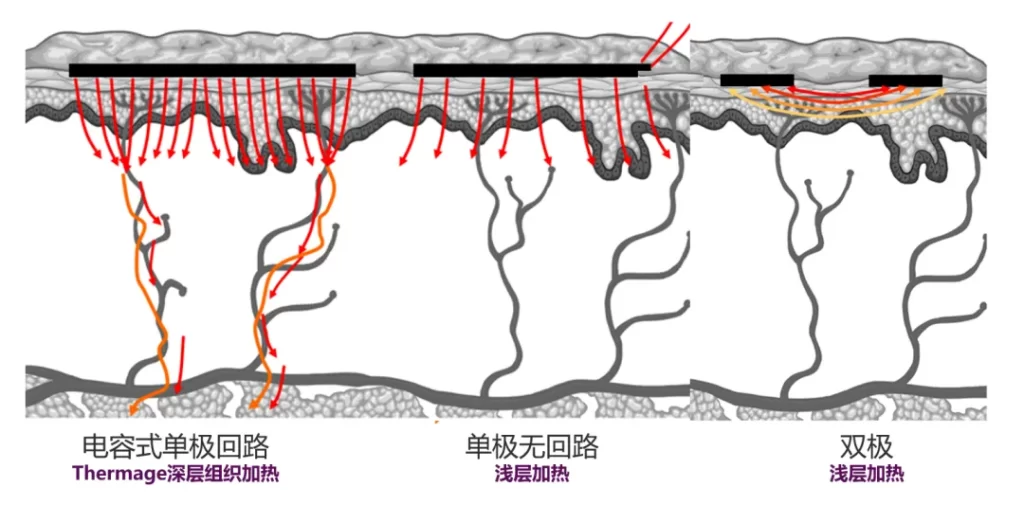 深扒 4 项医美项目，女明星冻颜的秘密藏不住了！