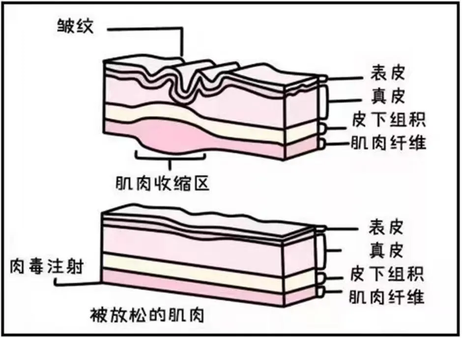 深扒 4 项医美项目，女明星冻颜的秘密藏不住了！