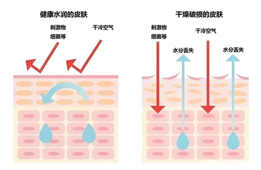 干皮老化的三大要素及日常该如何护理