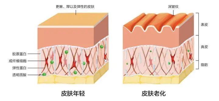 干皮老化的三大要素及日常该如何护理