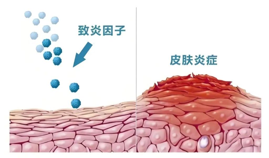 了解皮肤炎症，守护肌肤健康