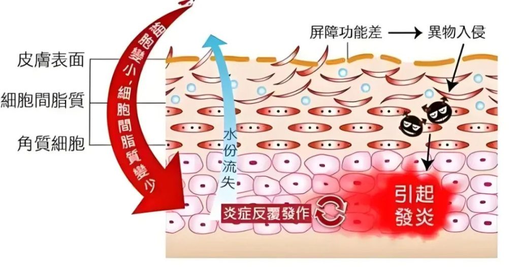 了解皮肤炎症，守护肌肤健康