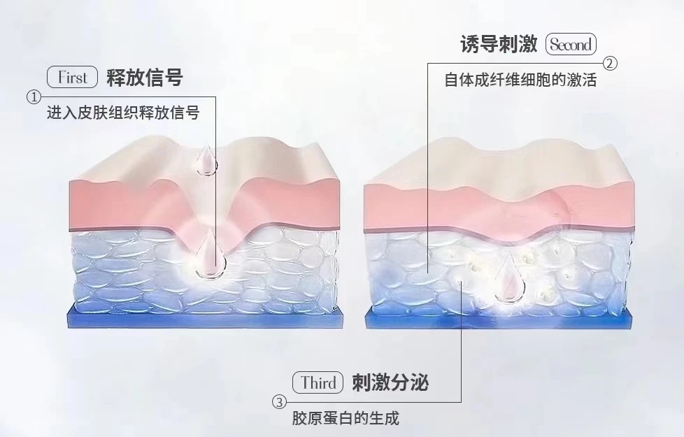 资本的骗局还是美丽的秘诀？童颜针到底有没有效？