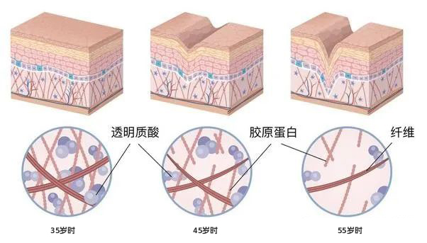 胶原蛋白、纤维细胞与衰老的关系