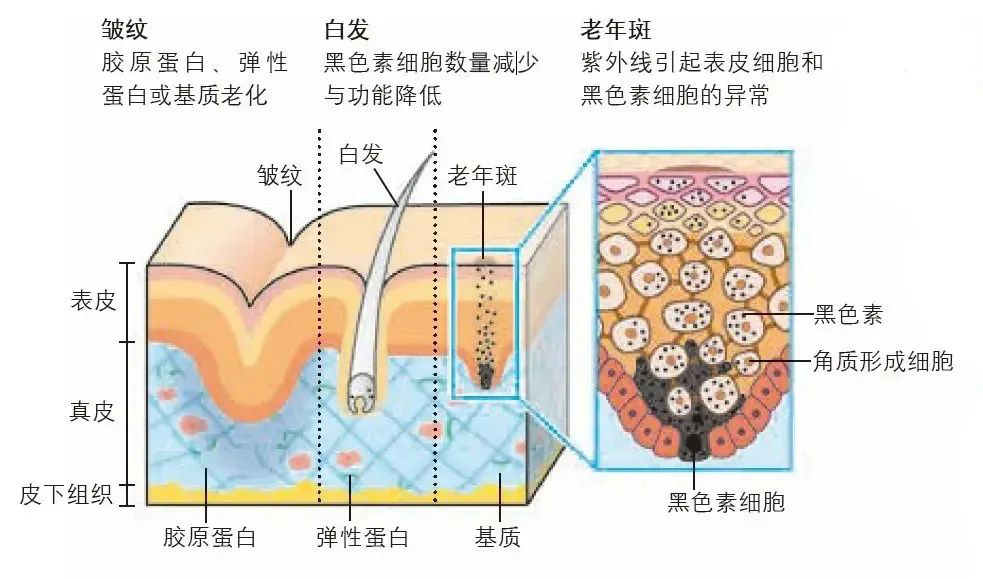 刚过40岁，为什么就长“老年斑”？色斑色沉，该如何去除？