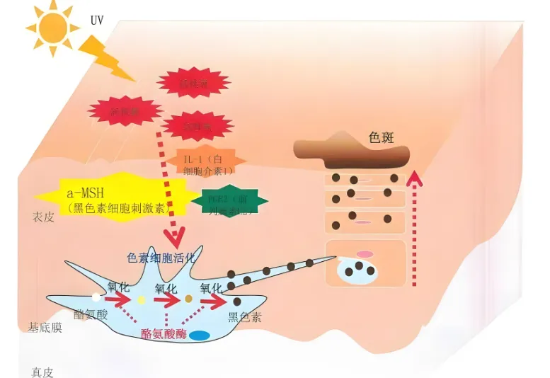 痘痘的形成过程及原因！