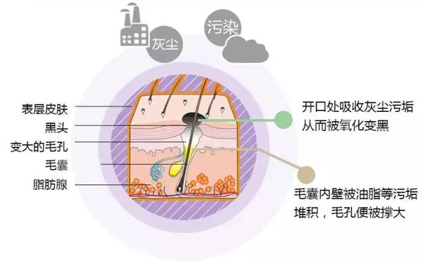 小气泡去黑头的常见问题解答